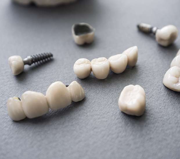 Fairfield The Difference Between Dental Implants and Mini Dental Implants